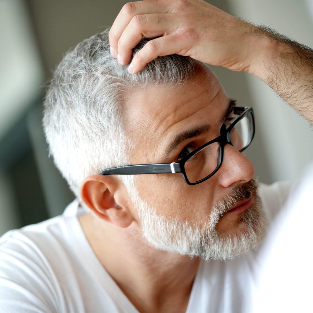 service-hair-transplant-head