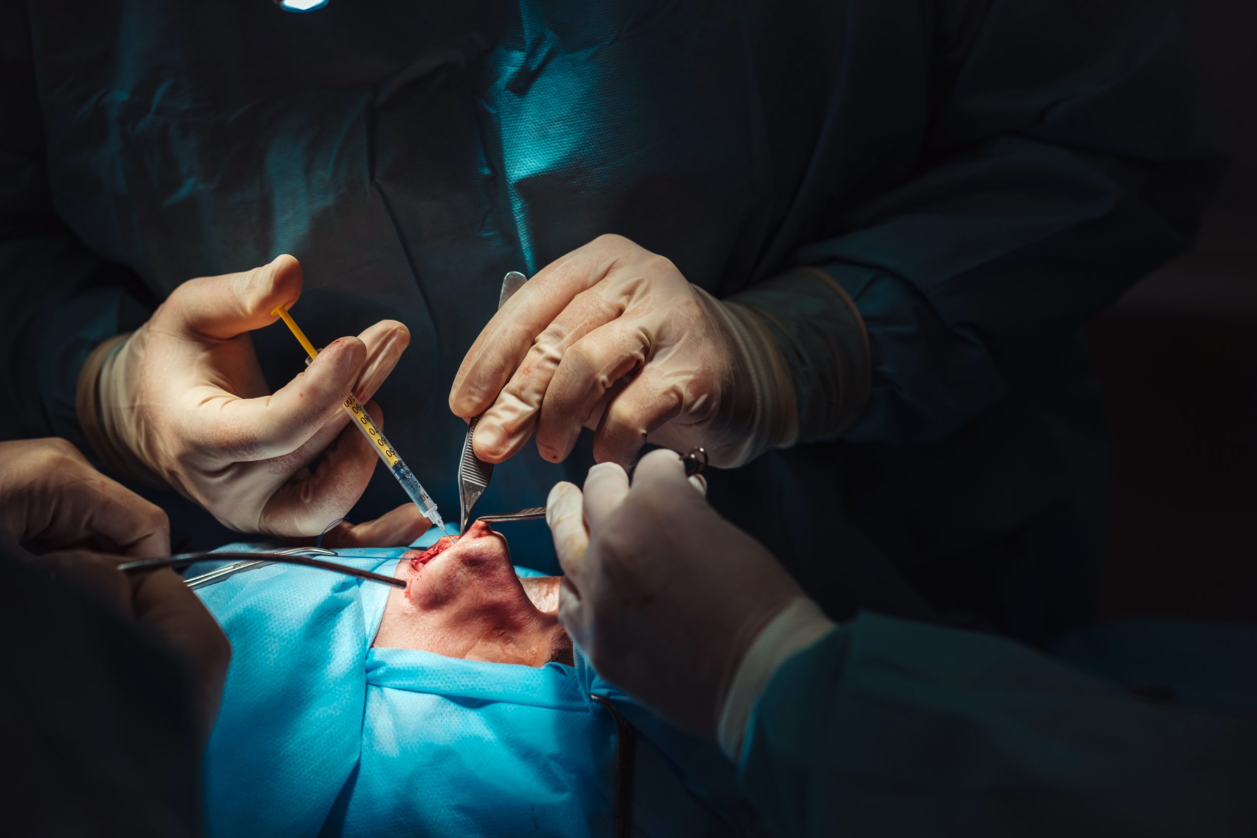 Cosmetic surgery on nose. Surgeon makes an injection