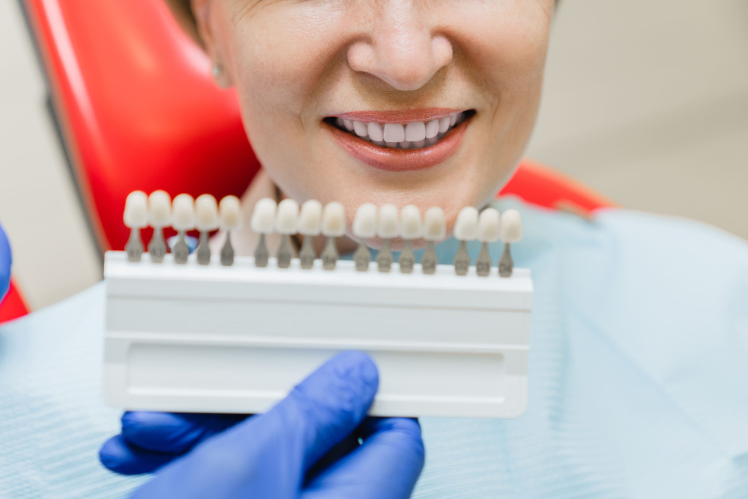 dentist-choosing-selecting-color-of-patient-s-teet-2023-11-27-05-36-09-utc (1)