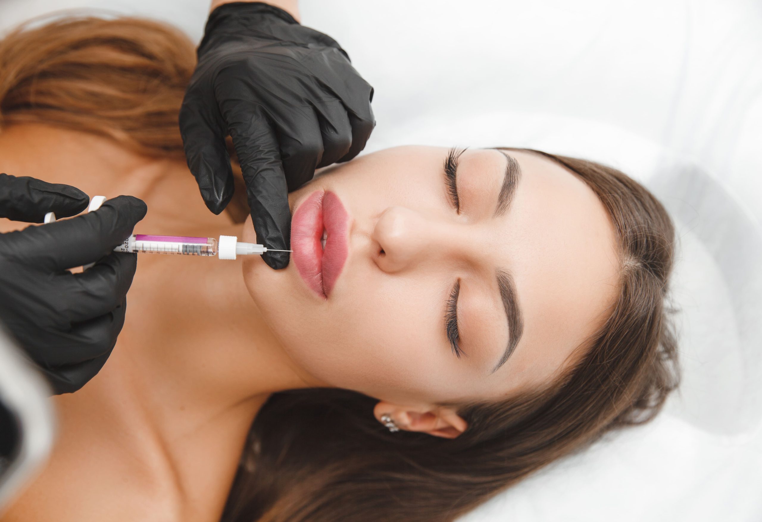 female-lips-lip-augmentation-procedure-a-syringe-2023-11-27-05-08-06-utc (1)